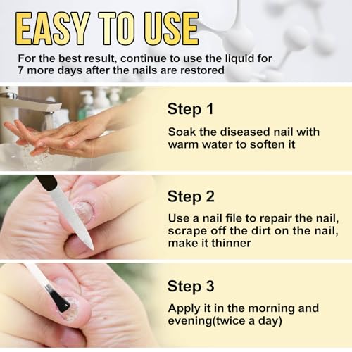 Toenail Fungus Treatment Extra Strength - Nail Fungus Treatment for Toenail - 30ml F9815