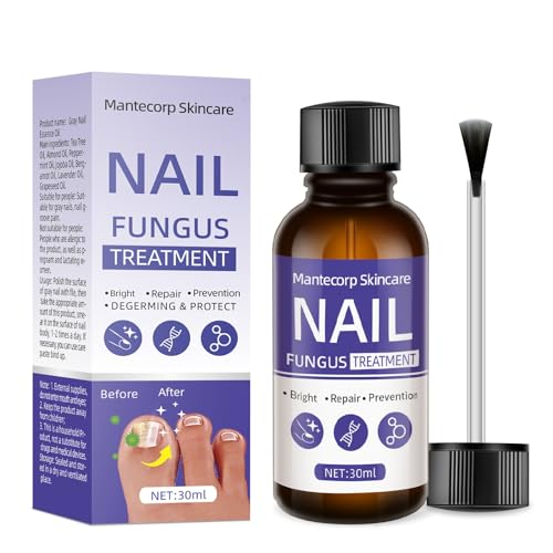 Toenail Fungus Treatment,Toenail Fungus Treatment Extra Strength,Nail Fungus Treatment Extra Strength for Athletes Foot, Thick, Broken, Discolored & Damaged Nail - Safely and Gently.-30ml