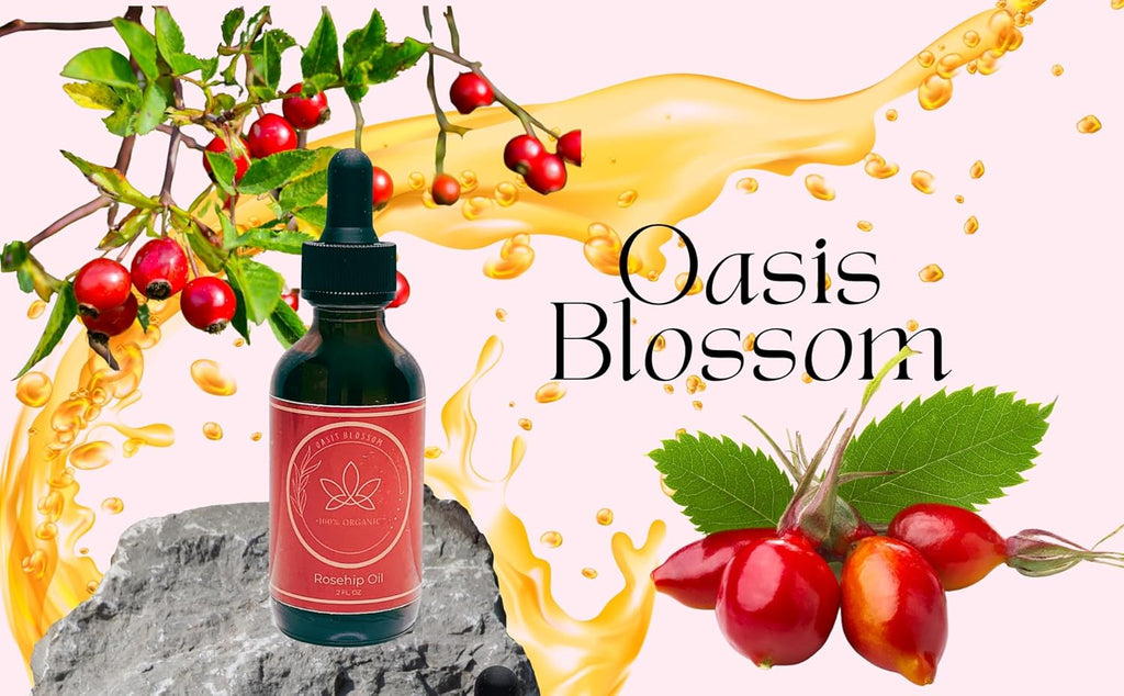 Rosehip Oil for Face, Skin & Hair, 100% Pure USDA Organic, Cold Pressed Unrefined, 2 Fl Oz T32475