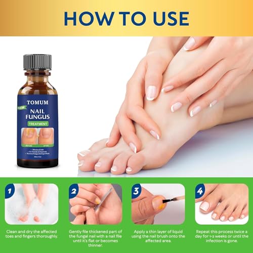 Toenail Fungus Treatment Extra Strength - 30 ml X75489