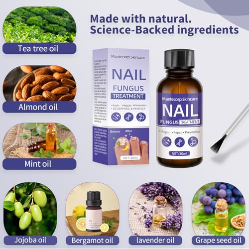 Toenail Fungus Treatment Extra Strength for Athletes Foot, 30ml F45884