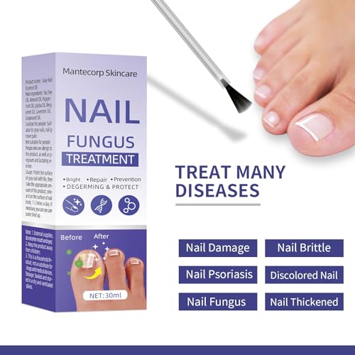 Toenail Fungus Treatment Extra Strength for Athletes Foot, 30ml F45884