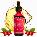 Rosehip Oil for Face, Skin & Hair| 100% Pure Certified USDA Organic | Cold Pressed Unrefined Rosehip Oil | Hydrating, Moisturizing, Nourishing, Anti-Aging | 2 Fl Oz.